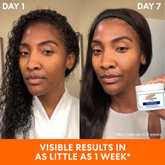 Anti-Dark Spot Extra Strength Tone Correcting Serum
